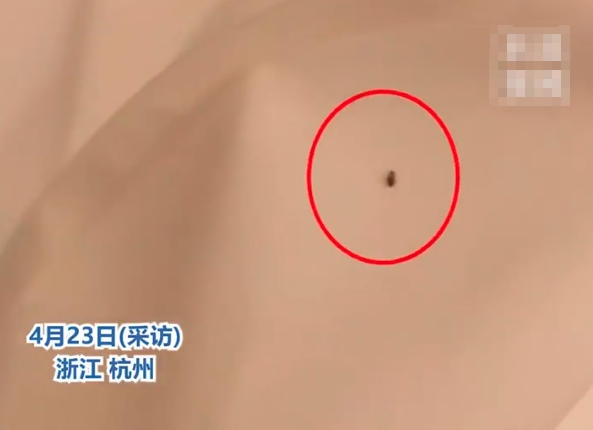 女生住亚朵酒店发现虱子满床跑，全身起红点酒店仅送两个枕头