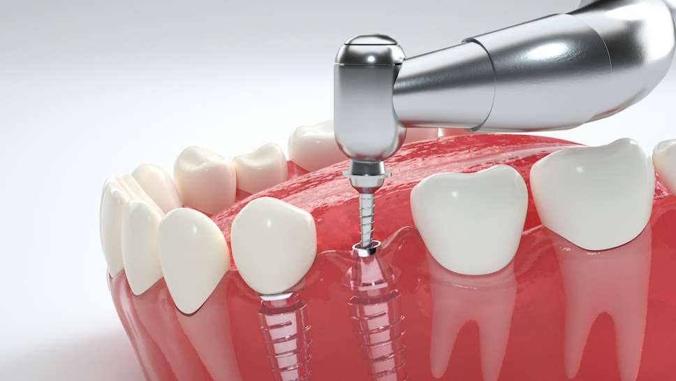 聚焦儿童青少年口腔健康，多方合力共筑防护体系